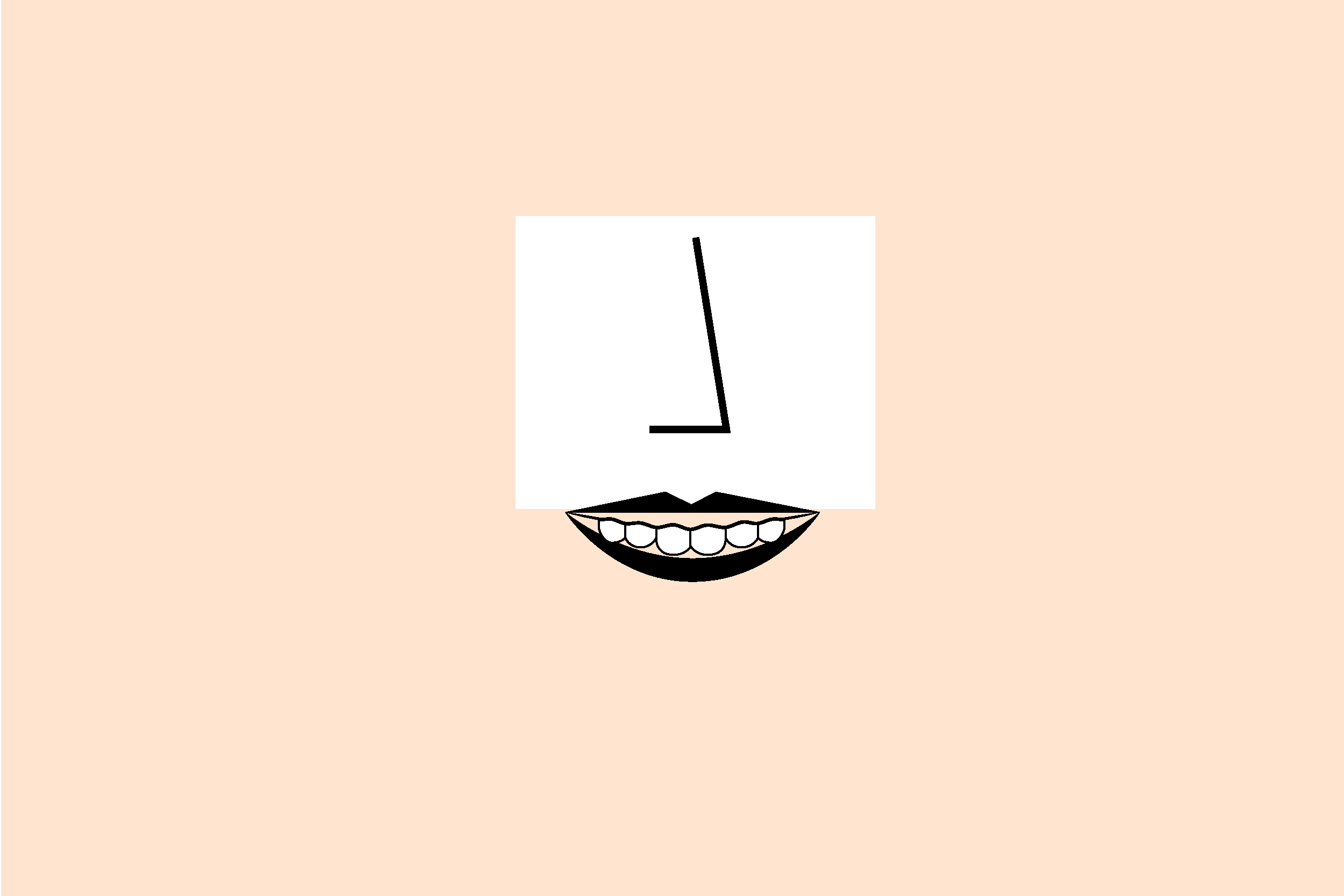 Gummy Smile